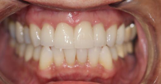 Advanced Dental Professionals -