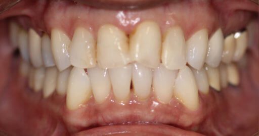 Advanced Dental Professionals -