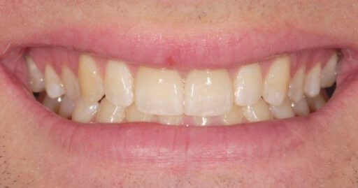Advanced Dental Professionals -