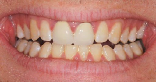 Advanced Dental Professionals -