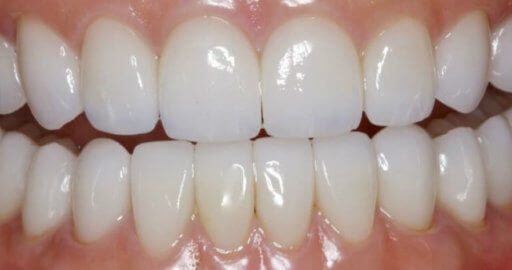 Advanced Dental Professionals -