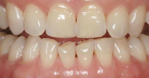 Advanced Dental Professionals -