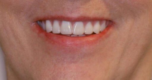 Advanced Dental Professionals -