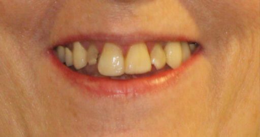Advanced Dental Professionals -