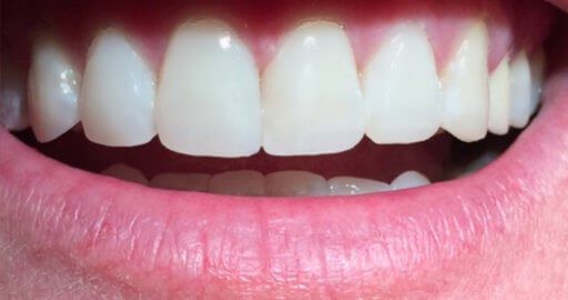 Advanced Dental Professionals -