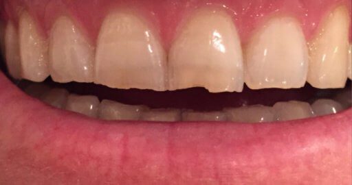 Advanced Dental Professionals -