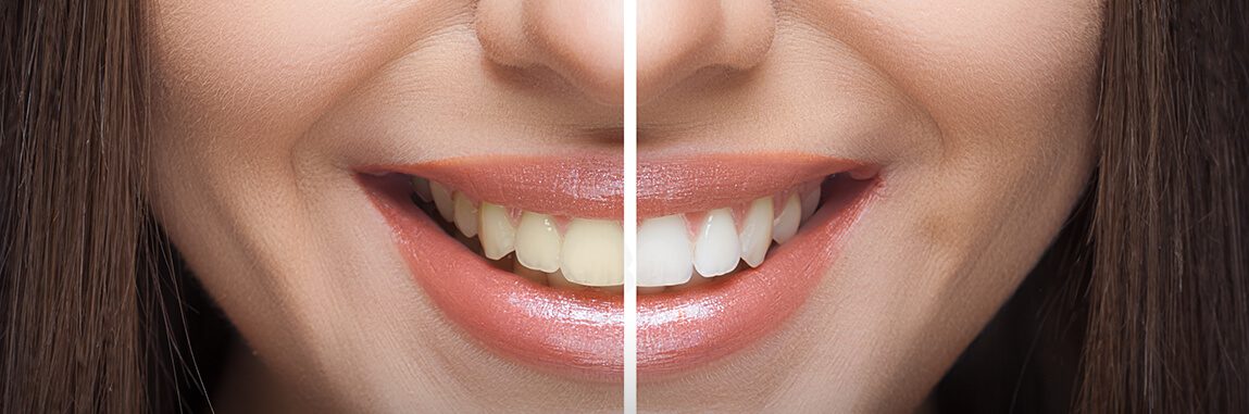 Advanced Dental Professionals -