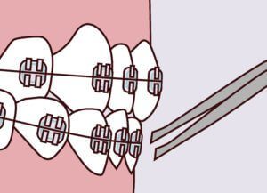 Advanced Dental Professionals -
