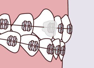 Advanced Dental Professionals -