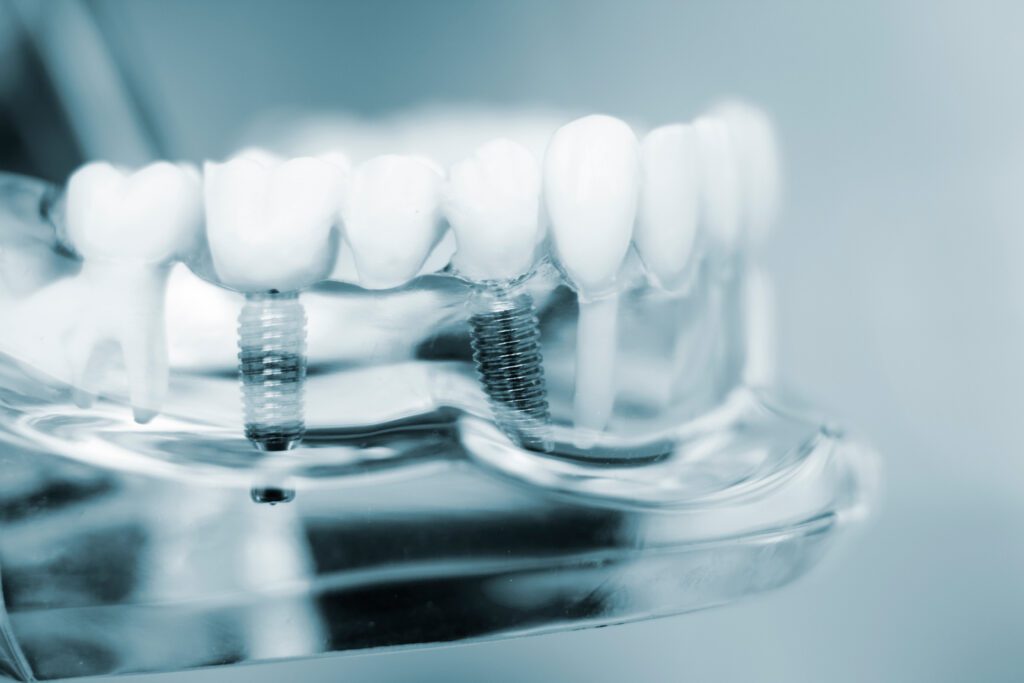 Advanced Dental Professionals -