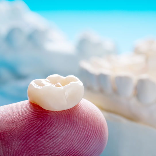 same-day crown Rapid City dental crown dentist near me