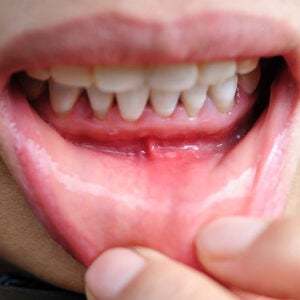 Advanced Dental Professionals -
